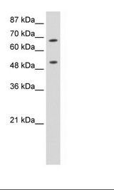 p84 / THOC1 Antibody - HepG2 Cell Lysate.  This image was taken for the unconjugated form of this product. Other forms have not been tested.