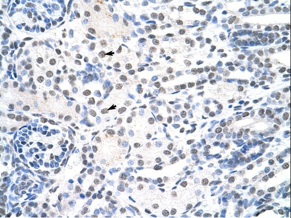 p84 / THOC1 Antibody - THOC1 antibody ARP40578_P050-NP_005122-THOC1 (THO complex 1) Antibody was used in IHC to stain formalin-fixed, paraffin-embedded human kidney.  This image was taken for the unconjugated form of this product. Other forms have not been tested.