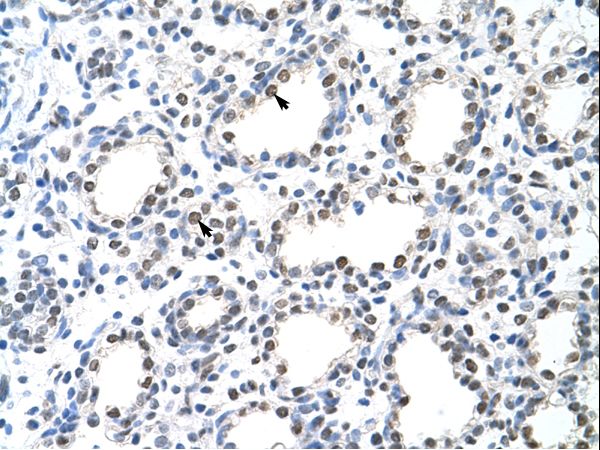 p84 / THOC1 Antibody - THOC1 antibody ARP40578_P050-NP_005122-THOC1 (THO complex 1) Antibody was used in IHC to stain formalin-fixed, paraffin-embedded human lung.  This image was taken for the unconjugated form of this product. Other forms have not been tested.
