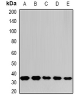 p84 / THOC1 Antibody - Western blot analysis of THOC1 expression in SHSY5Y (A); SW620 (B); NIH3T3 (C); mouse spleen (D); rat liver (E) whole cell lysates.