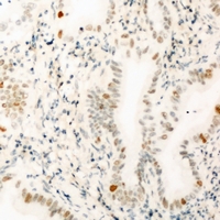p84 / THOC1 Antibody - Immunohistochemical analysis of THOC1 staining in mouse kidney formalin fixed paraffin embedded tissue section. The section was pre-treated using heat mediated antigen retrieval with sodium citrate buffer (pH 6.0). The section was then incubated with the antibody at room temperature and detected using an HRP conjugated compact polymer system. DAB was used as the chromogen. The section was then counterstained with hematoxylin and mounted with DPX.