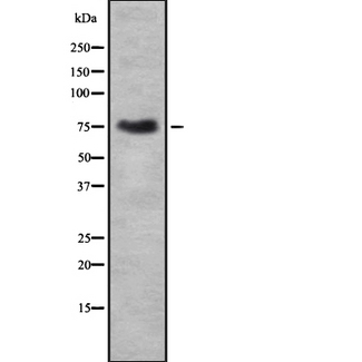 p84 / THOC1 Antibody - Western blot analysis of THOC1 using COLO205 whole cells lysates