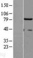p84 / THOC1 Protein - Western validation with an anti-DDK antibody * L: Control HEK293 lysate R: Over-expression lysate