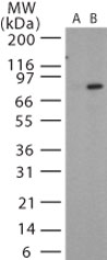 PA / Protective Antigen Antibody - Western blot of Anthrax PA in recombinant protein using antibody (Lane B) at 1:1000 dilution. Lane A shows the pre-bleed.