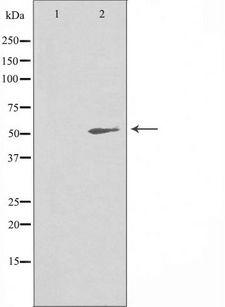 PA26 / SESN1 Antibody - Western blot analysis of extracts of rat muscle cells using SESN1 antibody. The lane on the left is treated with the antigen-specific peptide.