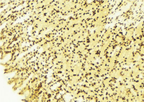 PA26 / SESN1 Antibody - 1:100 staining human gastric tissue by IHC-P. The sample was formaldehyde fixed and a heat mediated antigen retrieval step in citrate buffer was performed. The sample was then blocked and incubated with the antibody for 1.5 hours at 22°C. An HRP conjugated goat anti-rabbit antibody was used as the secondary.