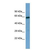PA26 / SESN1 Antibody - Western blot of Human THP-1. SESN1 antibody dilution 1.0 ug/ml.  This image was taken for the unconjugated form of this product. Other forms have not been tested.