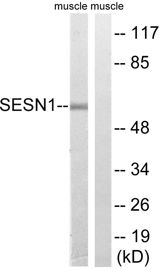 PA26 / SESN1 Antibody - Western blot analysis of lysates from rat muscle cells, using SESN1 Antibody. The lane on the right is blocked with the synthesized peptide.