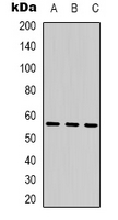 PA26 / SESN1 Antibody - Western blot analysis of SESN1 expression in K562 (A); HeLa (B); rat muscle (C) whole cell lysates.