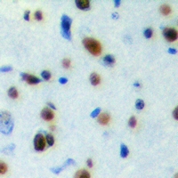 PA26 / SESN1 Antibody - Immunohistochemical analysis of SESN1 staining in human brain formalin fixed paraffin embedded tissue section. The section was pre-treated using heat mediated antigen retrieval with sodium citrate buffer (pH 6.0). The section was then incubated with the antibody at room temperature and detected with HRP and DAB as chromogen. The section was then counterstained with hematoxylin and mounted with DPX.