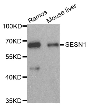 PA26 / SESN1 Antibody - Western blot analysis of extracts of various cell lines.