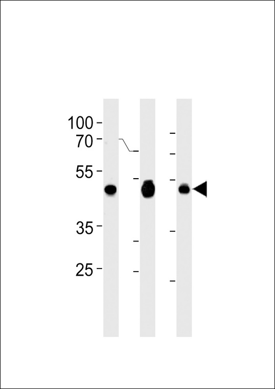 PA2G4 / EBP1 Antibody - EBP1 Antibody western blot of A2058,Jurkat,MCF-7 cell line lysates (35 ug/lane). The EBP1 antibody detected the EBP1 protein (arrow).