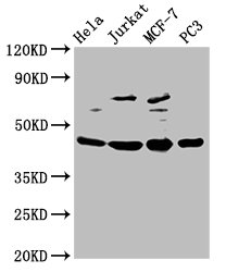 PA2G4 / EBP1 Antibody - Western Blot Positive WB detected in: Hela whole cell lysate, Jurkat whole cell lysate, MCF-7 whole cell lysate, PC-3 whole cell lysate All lanes: PA2G4 antibody at 2.5µg/ml Secondary Goat polyclonal to rabbit IgG at 1/50000 dilution Predicted band size: 44, 39 kDa Observed band size: 44 kDa