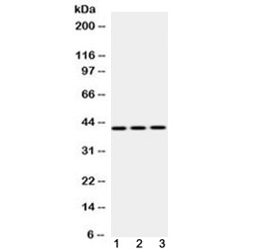 PA2G4 / EBP1 Antibody - Western blot testing of 1) rat liver, 2) mouse NIH3T3 and 3) human HepG2 lysate with EBP1 antibody at 0.5ug/ml. Observed molecular weight 42 kDa (p42 isoform) and 48 kDa (p48 isoform).