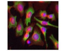 PABPC1 / PABP1 Antibody - Immunocytochemistry/ Immunofluorescence-PABP antibody [10E10] stained HeLa cells