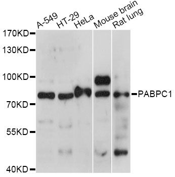 PABPC1 / PABP1 Antibody - Western blot analysis of extracts of various cell lines, using PABPC1 antibody at 1:1000 dilution. The secondary antibody used was an HRP Goat Anti-Rabbit IgG (H+L) at 1:10000 dilution. Lysates were loaded 25ug per lane and 3% nonfat dry milk in TBST was used for blocking. An ECL Kit was used for detection and the exposure time was 30s.
