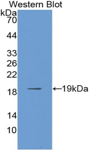 PABPC1L Antibody - Western blot of recombinant C20orf119.  This image was taken for the unconjugated form of this product. Other forms have not been tested.