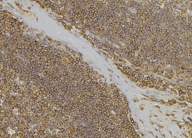 PABPC3 Antibody - 1:100 staining human lymph node tissue by IHC-P. The sample was formaldehyde fixed and a heat mediated antigen retrieval step in citrate buffer was performed. The sample was then blocked and incubated with the antibody for 1.5 hours at 22°C. An HRP conjugated goat anti-rabbit antibody was used as the secondary.
