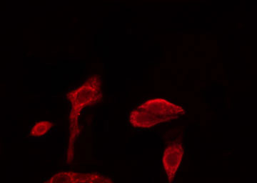 PABPC3 Antibody - Staining NIH-3T3 cells by IF/ICC. The samples were fixed with PFA and permeabilized in 0.1% Triton X-100, then blocked in 10% serum for 45 min at 25°C. The primary antibody was diluted at 1:200 and incubated with the sample for 1 hour at 37°C. An Alexa Fluor 594 conjugated goat anti-rabbit IgG (H+L) antibody, diluted at 1/600, was used as secondary antibody.