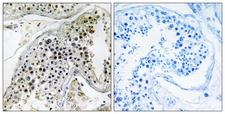 PABPC3 Antibody - Peptide - + Immunohistochemistry analysis of paraffin-embedded human testis tissue using PABPC3 antibody.