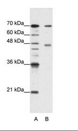 PABPC4 Antibody - A: Marker, B: HepG2 Cell Lysate.  This image was taken for the unconjugated form of this product. Other forms have not been tested.