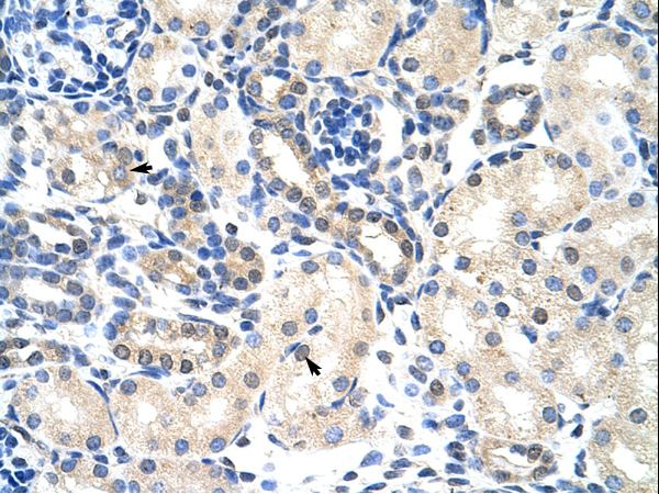 PABPC4 Antibody - PABPC4 antibody ARP40496_T100-NP_003810-PABPC4 (poly(A) binding protein, cytoplasmic 4 (inducible form)) Antibody was used in IHC to stain formalin-fixed, paraffin-embedded human kidney.  This image was taken for the unconjugated form of this product. Other forms have not been tested.