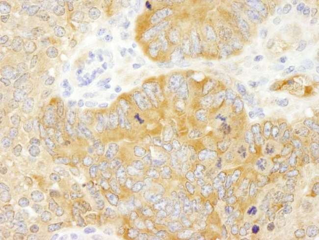 PABPC4 Antibody - Detection of Mouse PABP4 by Immunohistochemistry. Sample: FFPE section of mouse teratoma. Antibody: Affinity purified rabbit anti-PABP4 used at a dilution of 1:250.