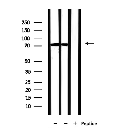 PABPC4 Antibody - Western blot analysis of extracts of mouse muscle, mouse liver tissue using PABPC4 antibody.