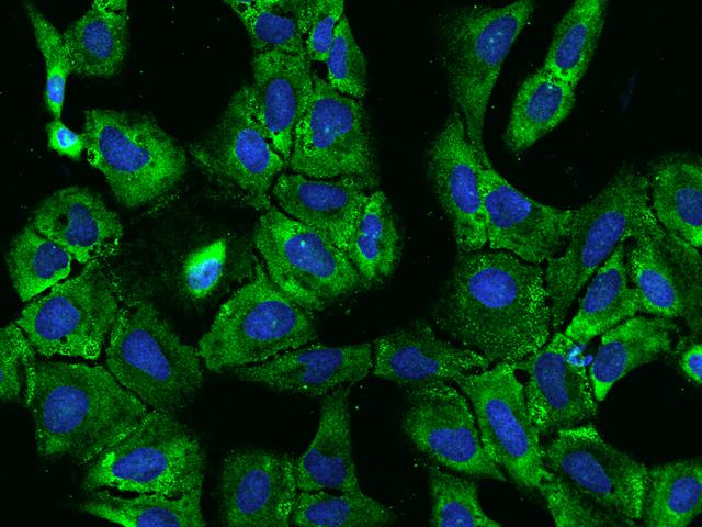 PABPC4 Antibody - Immunofluorescence staining of PABPC4 in U2OS cells. Cells were fixed with 4% PFA, permeabilzed with 0.1% Triton X-100 in PBS, blocked with 10% serum, and incubated with rabbit anti-Human PABPC4 polyclonal antibody (dilution ratio 1:1000) at 4°C overnight. Then cells were stained with the Alexa Fluor 488-conjugated Goat Anti-rabbit IgG secondary antibody (green) and counterstained with DAPI (blue). Positive staining was localized to Cytoplasm.