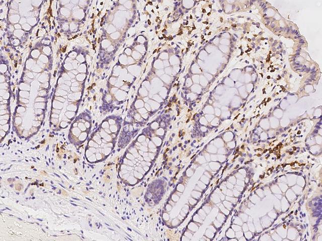 PABPC4 Antibody - Immunochemical staining of human PABPC4 in human rectum with rabbit polyclonal antibody at 1:2500 dilution, formalin-fixed paraffin embedded sections.