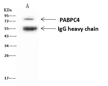 PABPC4 Antibody - PABPC4 was immunoprecipitated using: Lane A: 0.5 mg U-251 MG Whole Cell Lysate. 1 uL anti-PABPC4 rabbit polyclonal antibody and 60 ug of Immunomagnetic beads Protein A/G. Primary antibody: Anti-PABPC4 rabbit polyclonal antibody, at 1:500 dilution. Secondary antibody: Goat Anti-Rabbit IgG (H+L)/HRP at 1/10000 dilution. Developed using the ECL technique. Performed under reducing conditions. Predicted band size: 71 kDa. Observed band size: 75 kDa.
