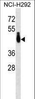 PABPC4L Antibody - PABPC4L Antibody western blot of NCI-H292 cell line lysates (35 ug/lane). The PABPC4L antibody detected the PABPC4L protein (arrow).