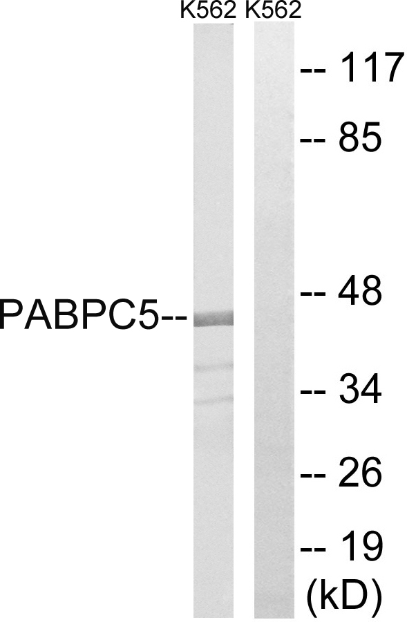 PABPC5 Antibody - Western blot analysis of lysates from K562 cells, using PABPC5 Antibody. The lane on the right is blocked with the synthesized peptide.