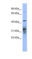 PABPC5 Antibody - PABPC5 antibody Western blot of NCI-H226 cell lysate. This image was taken for the unconjugated form of this product. Other forms have not been tested.