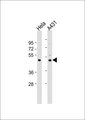 PABPC5 Antibody - All lanes: Anti-PABPC5 Antibody at 1:1000 dilution. Lane 1: HeLa whole cell lysate. Lane 2: A431 whole cell lysate Lysates/proteins at 20 ug per lane. Secondary Goat Anti-Rabbit IgG, (H+L), Peroxidase conjugated at 1:10000 dilution. Predicted band size: 43 kDa. Blocking/Dilution buffer: 5% NFDM/TBST.