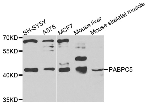 PABPC5 Antibody - Western blot analysis of extracts of various cells.