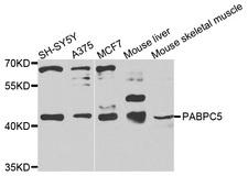 PABPC5 Antibody - Western blot analysis of extracts of various cells.