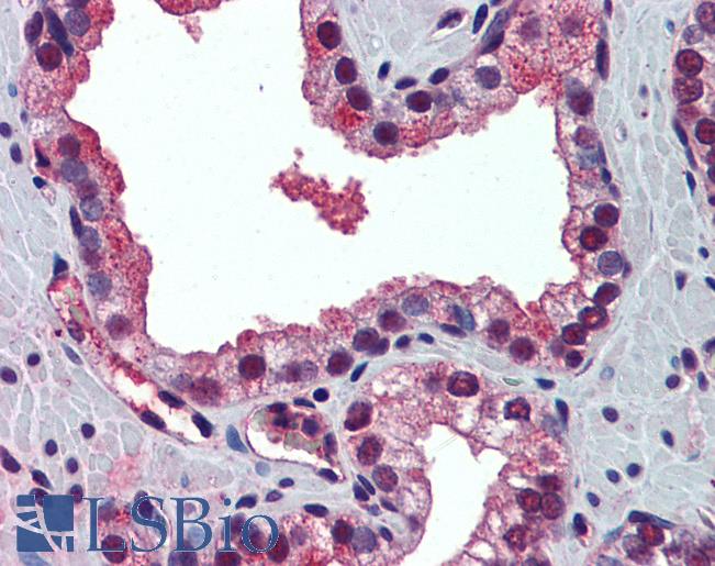 PABPN1 / PABP2 Antibody - Anti-PABPN1 antibody IHC of human prostate. Immunohistochemistry of formalin-fixed, paraffin-embedded tissue after heat-induced antigen retrieval. Antibody concentration 5 ug/ml.  This image was taken for the unconjugated form of this product. Other forms have not been tested.