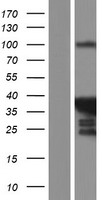 PABPN1L Protein - Western validation with an anti-DDK antibody * L: Control HEK293 lysate R: Over-expression lysate