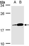 PACAP Antibody - Sample (30 ug whole cell lysate). A: MOLT4 , B: Raji . 15% SDS PAGE. PACAP antibody diluted at 1:1000