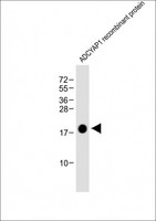 PACAP Antibody - Anti-ADCYAP1 Antibody at 1:8000 dilution + ADCYAP1 recombinant protein Lysates/proteins at 20ng per lane. Secondary Goat Anti-mouse IgG, (H+L), Peroxidase conjugated at 1/10000 dilution. Predicted band size: 18 kDa Blocking/Dilution buffer: 5% NFDM/TBST.