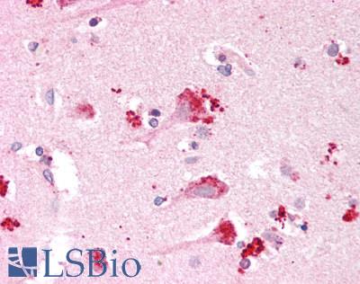 PACAP Antibody - Human Brain, Cortex: Formalin-Fixed, Paraffin-Embedded (FFPE)