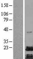 PACAP Protein - Western validation with an anti-DDK antibody * L: Control HEK293 lysate R: Over-expression lysate