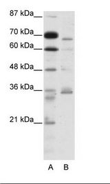 PACE4 / PCSK6 Antibody - A: Marker, B: HepG2 Cell Lysate.  This image was taken for the unconjugated form of this product. Other forms have not been tested.