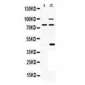 PACE4 / PCSK6 Antibody - PACE4 antibody Western blot. All lanes: Anti PACE4 at 0.5 ug/ml. Lane 1: Rat Brain Tissue Lysate at 50 ug. Lane 2: 293T Whole Cell Lysate at 40 ug. Predicted band size: 80 kD, 45/80/100 kD. Observed band size: 80 kD, 45/80/100 kD.