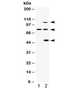 PACE4 / PCSK6 Antibody