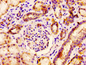 PACE4 / PCSK6 Antibody - Immunohistochemistry image at a dilution of 1:400 and staining in paraffin-embedded human kidney tissue performed on a Leica BondTM system. After dewaxing and hydration, antigen retrieval was mediated by high pressure in a citrate buffer (pH 6.0) . Section was blocked with 10% normal goat serum 30min at RT. Then primary antibody (1% BSA) was incubated at 4 °C overnight. The primary is detected by a biotinylated secondary antibody and visualized using an HRP conjugated SP system.