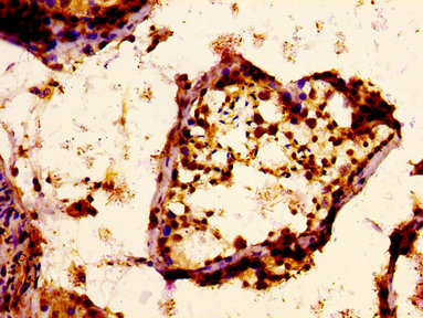 PACE4 / PCSK6 Antibody - Immunohistochemistry image at a dilution of 1:400 and staining in paraffin-embeddedhuman testis tissue performed on a Leica BondTM system. After dewaxing and hydration, antigen retrieval was mediated by high pressure in a citrate buffer (pH 6.0) . Section was blocked with 10% normal goat serum 30min at RT. Then primary antibody (1% BSA) was incubated at 4 °C overnight. The primary is detected by a biotinylated secondary antibody and visualized using an HRP conjugated ABC system.