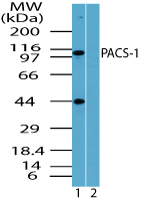 PACS1 Antibody - Western blot of PACS-1 in human uterus lysate in the 1) absence and 2) presence of immunizing peptide using Peptide-affinity Purified Polyclonal Antibody to PACS-1 at 0.05 ug/ml.