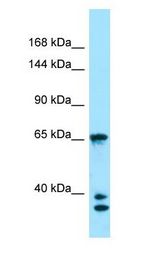 PACS1 Antibody - PACS1 antibody Western Blot of 293T.  This image was taken for the unconjugated form of this product. Other forms have not been tested.